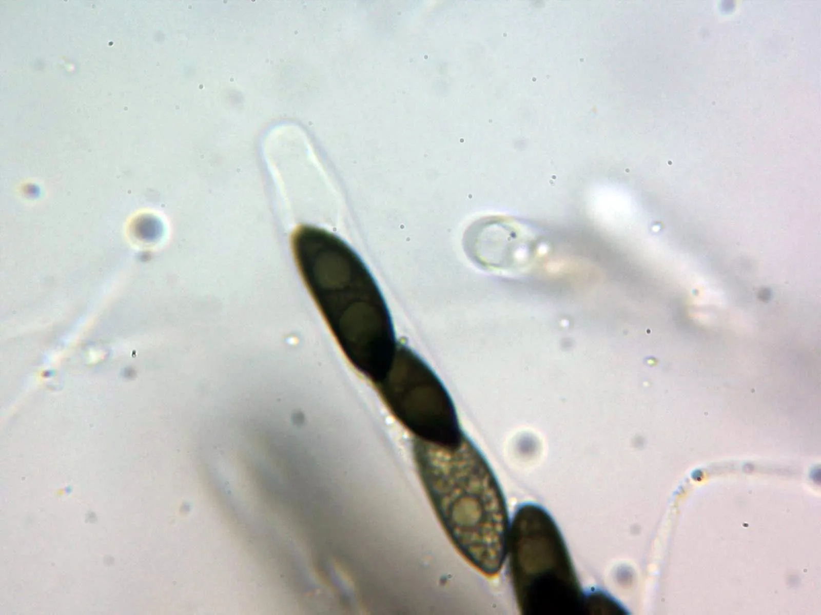 Microscopía de Rosellinia aquila - 10 - Asca en agua